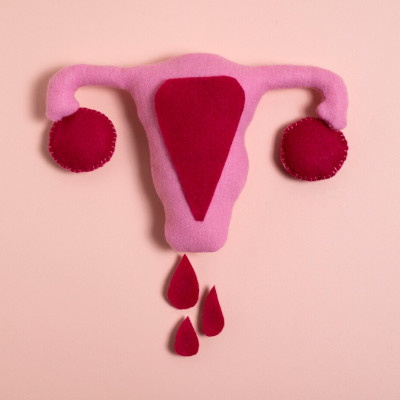 Endometriose